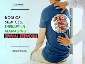 stem cell therapy spinal stenosis
