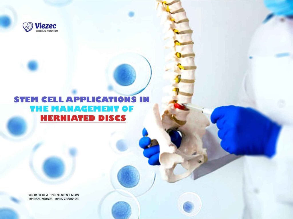 Stem Cell Applications in the Management of Herniated Discs