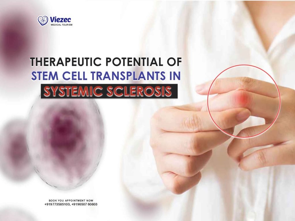 Therapeutic Potential of Stem Cell Transplants in Systemic Sclerosis