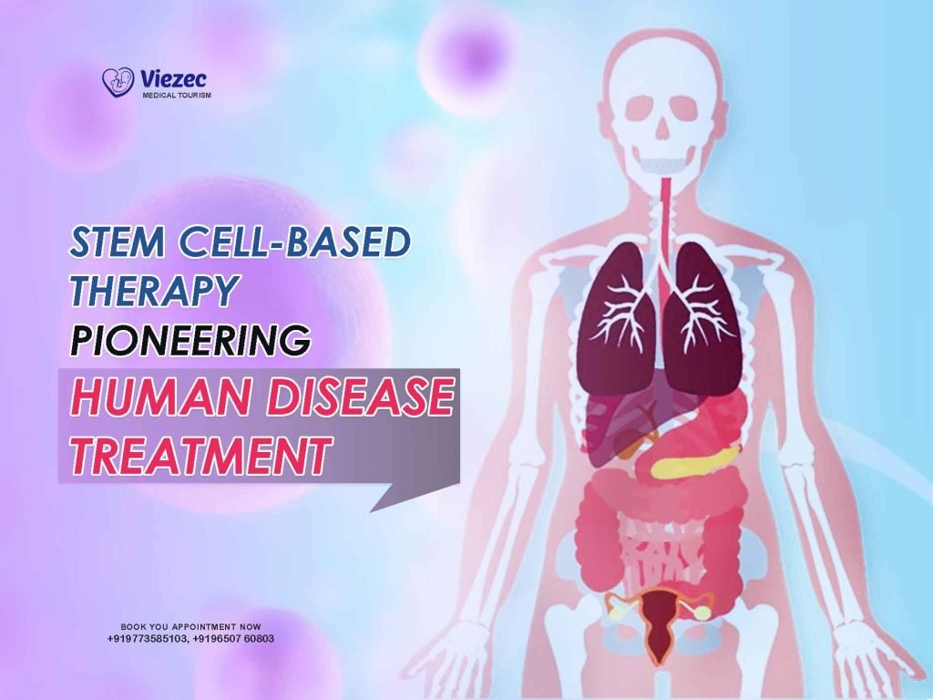 stem cell based therapy