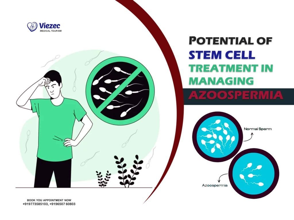 Potential of Stem Cell Treatment in Managing Azoospermia