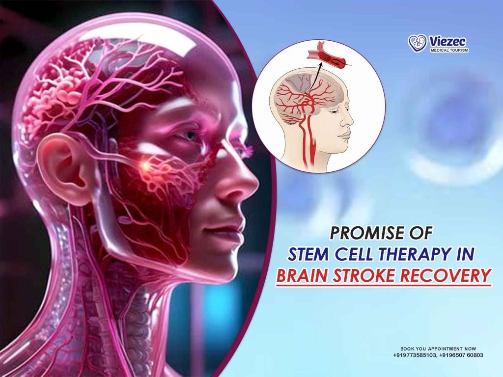brain stroke recovery