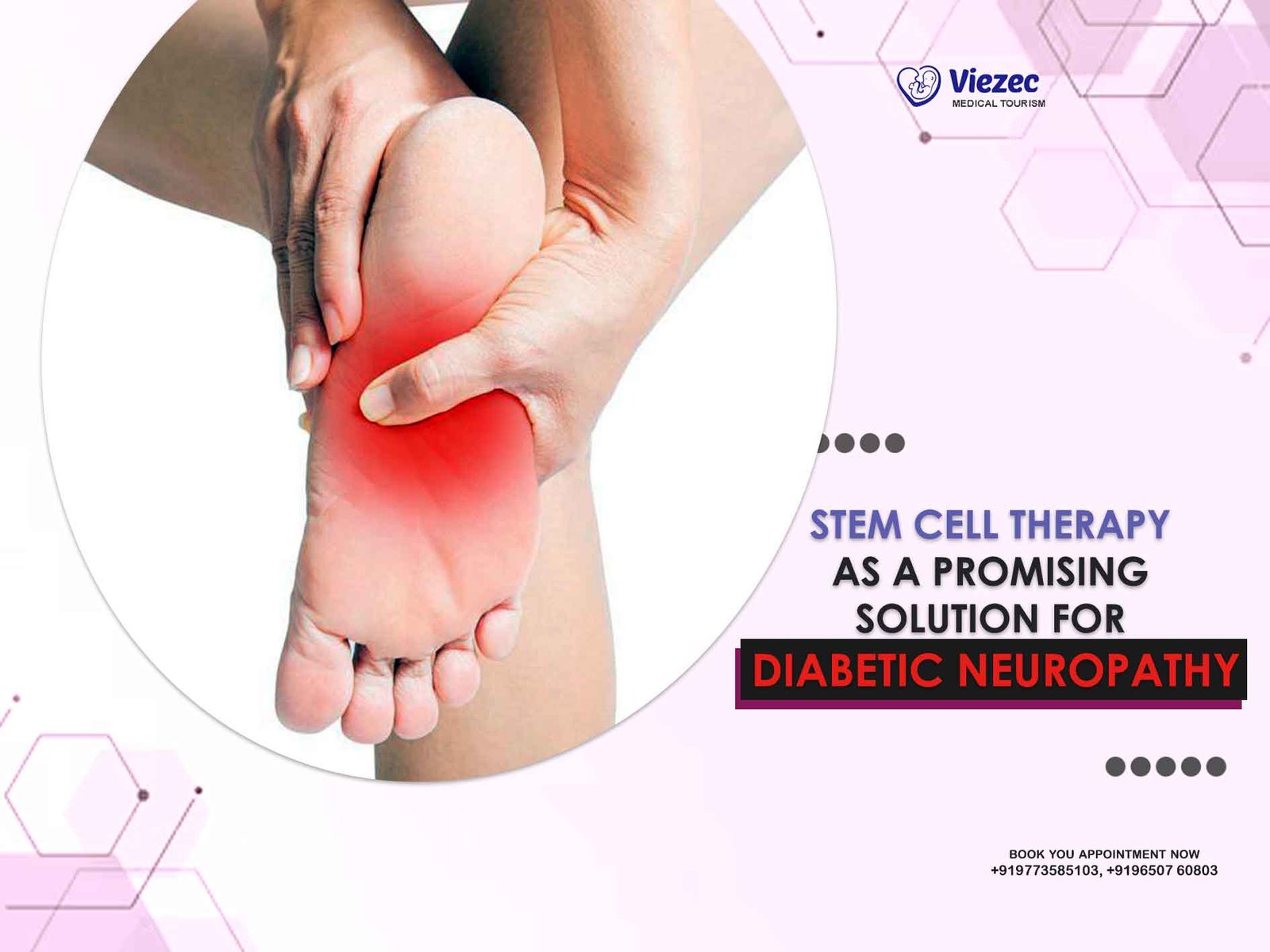 Diabetic Neuropathy