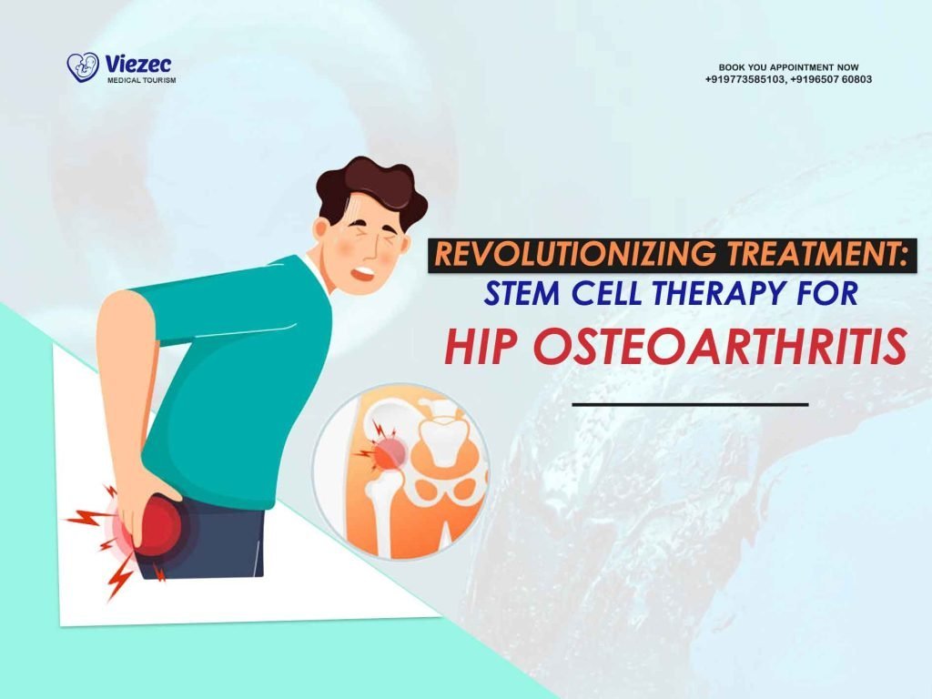 Revolutionizing Treatment: Stem Cell Therapy for Hip Osteoarthritis