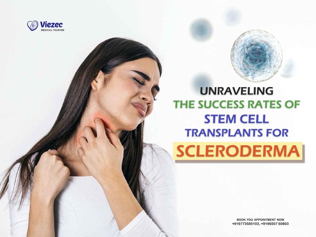 Stem cell transplant success rate for scleroderma