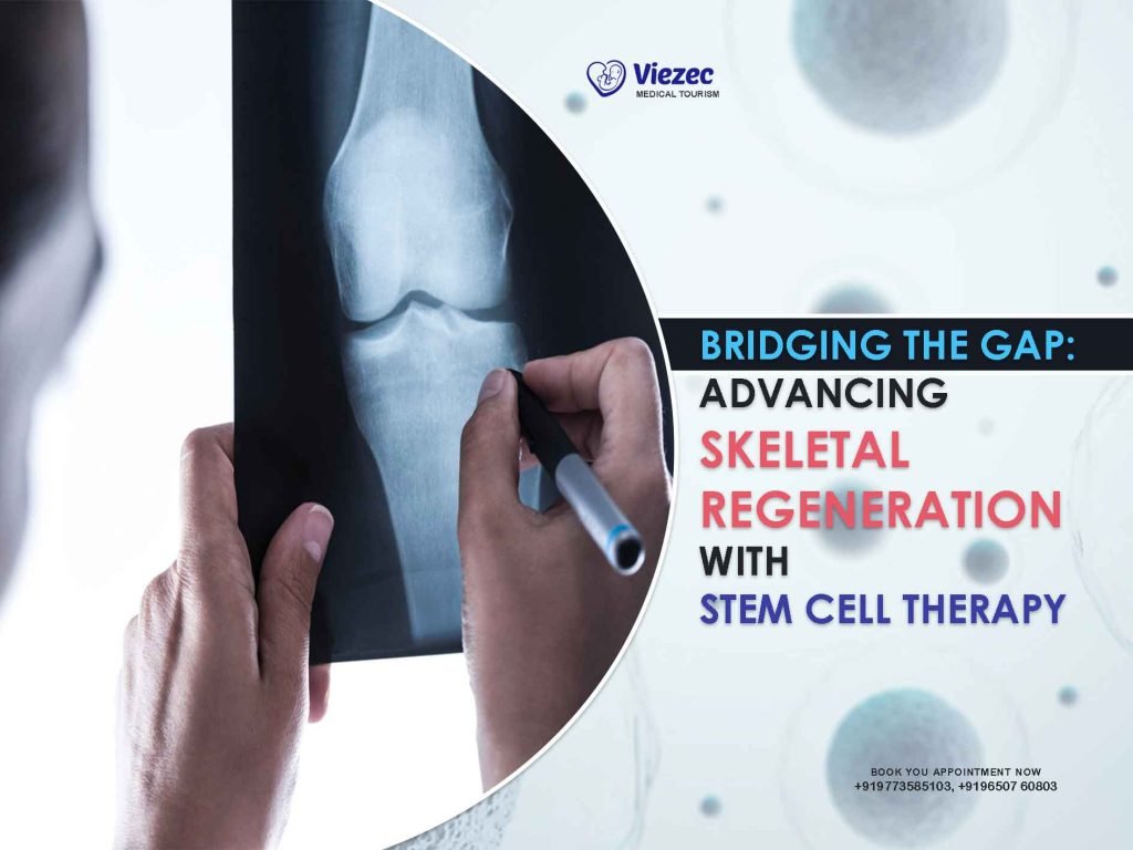 Skeletal Regeneration with Stem Cell Therapy