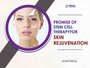 Promise of Stem Cell Therapy for Skin Rejuvenation