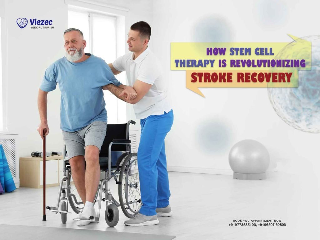 How Stem Cell Therapy is Revolutionizing Stroke Recovery