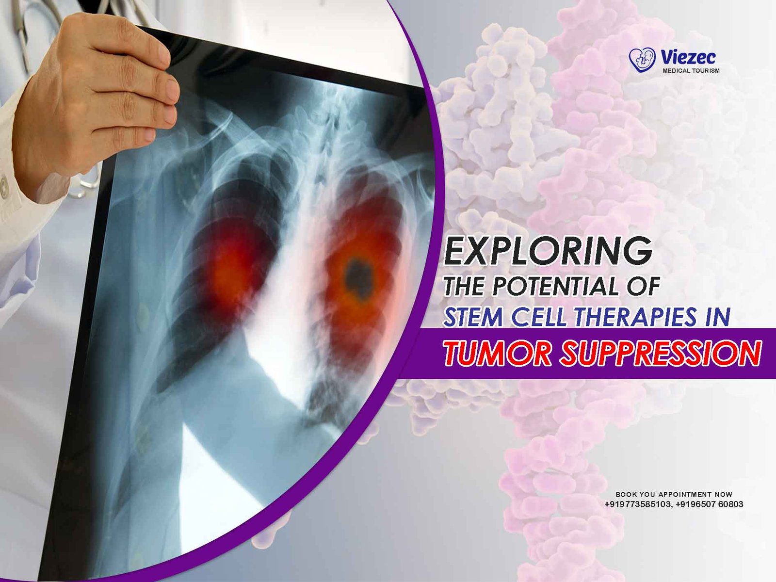 stem cell for tumor