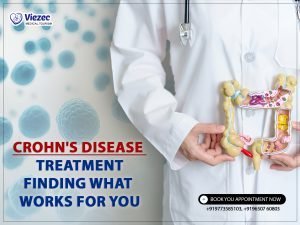 Crohn's Disease Treatment: Finding What Works for You