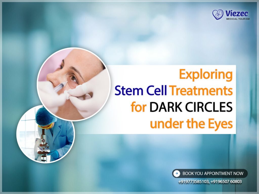 Exploring Stem Cell Treatments for Dark Circles under the Eyes