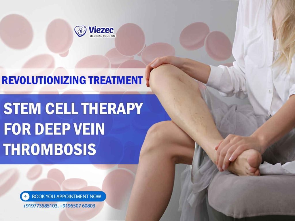 Revolutionizing Treatment: Stem Cell Therapy for Deep Vein Thrombosis