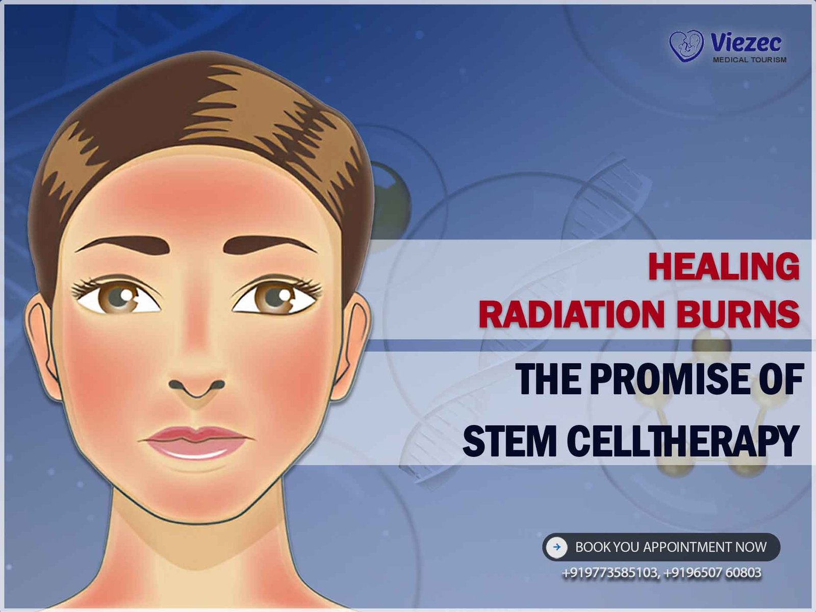 Radiation Burns