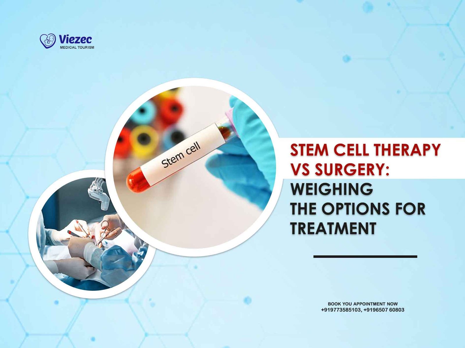 Stem Cell Therapy vs Surgery: Weighing the Options for Treatment