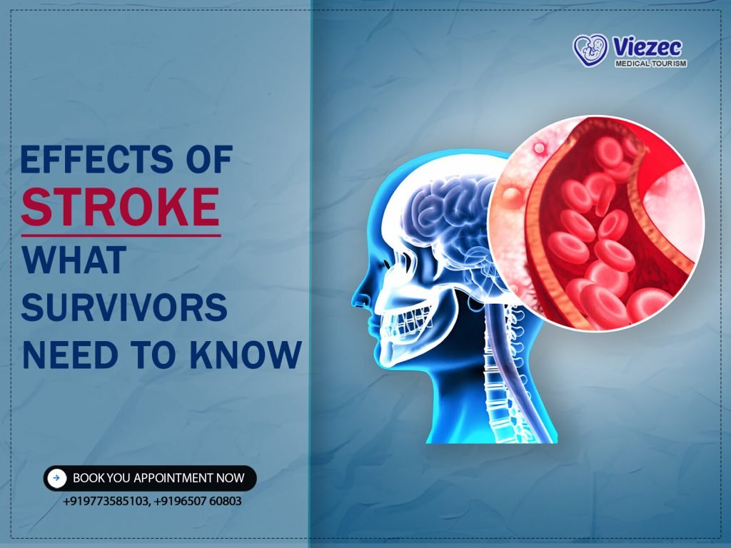 Key Effects of Stroke and How to Manage Them