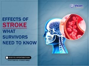 Key Effects of Stroke and How to Manage Them