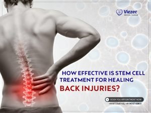 How Effective is Stem Cell Treatment for Healing Back Injuries?