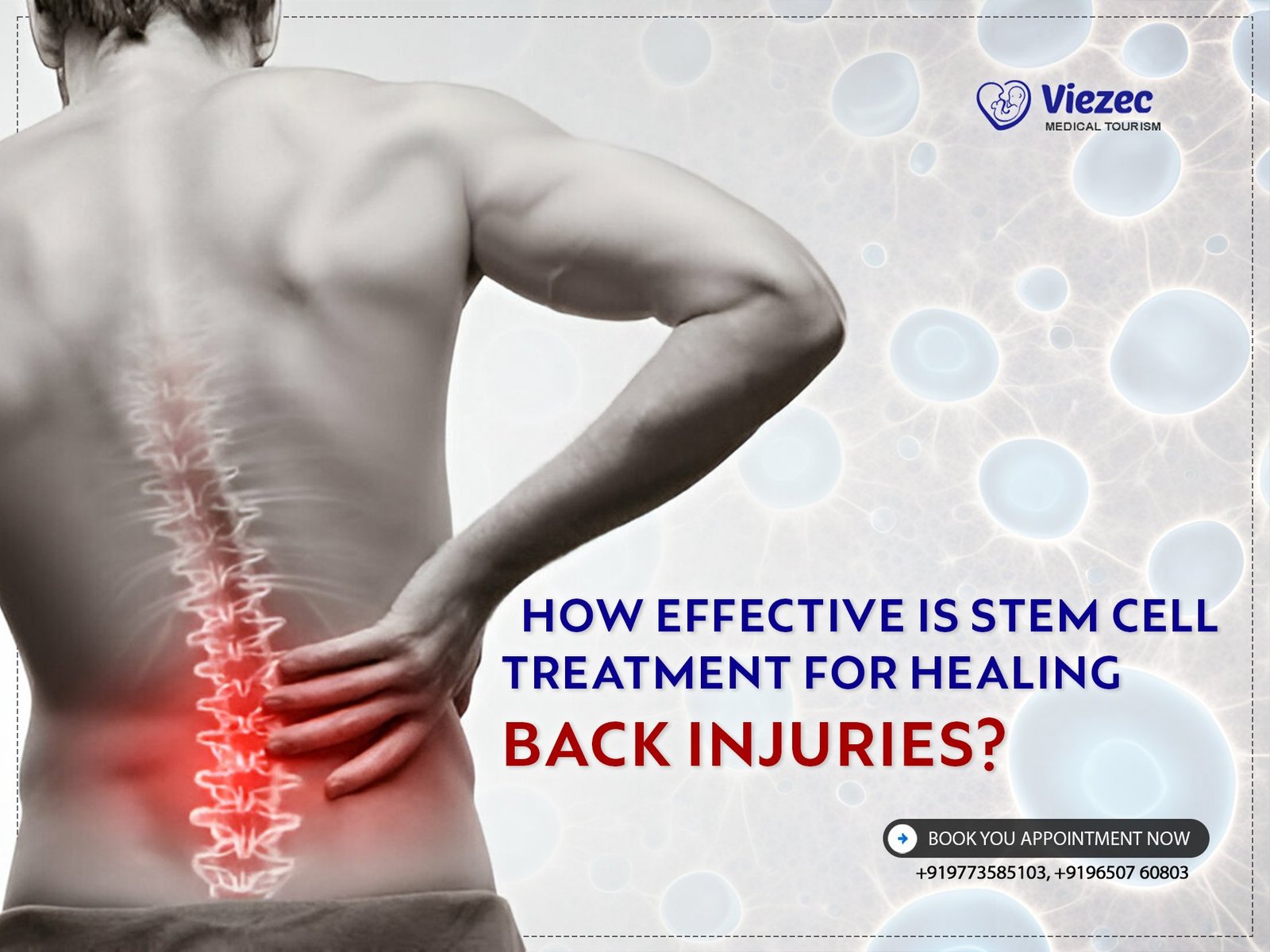 How Effective is Stem Cell Treatment for Healing Back Injuries?