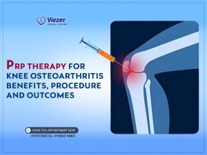 PRP Therapy for Knee Osteoarthritis