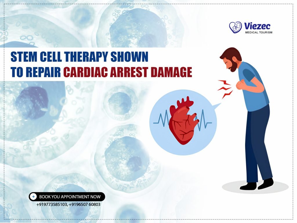 Cardiac Arrest Damage