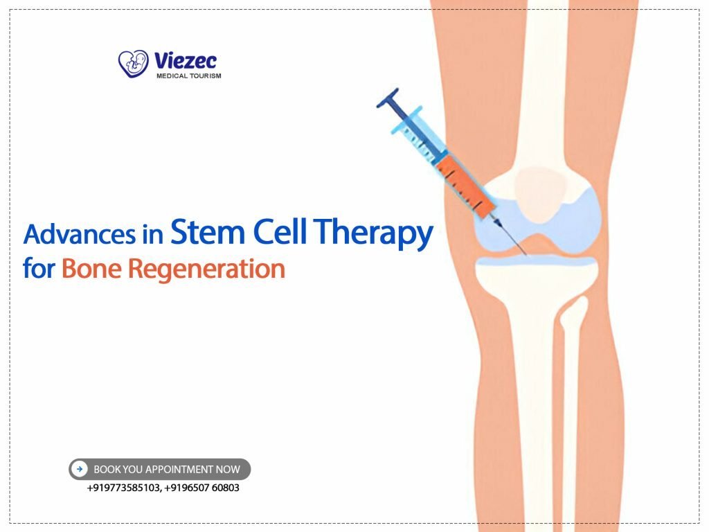 Advances in Stem Cell Therapy for Bone Regeneration