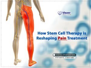 Pain Treatment