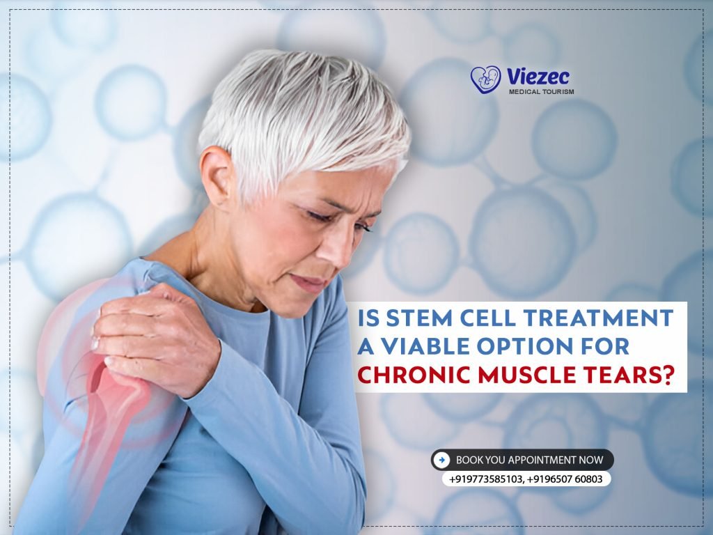 Is Stem Cell Treatment a Viable Option for Chronic Muscle Tears?