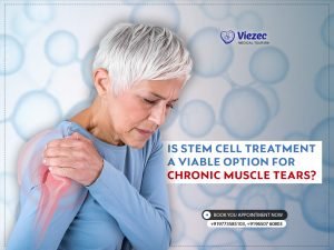 Is Stem Cell Treatment a Viable Option for Chronic Muscle Tears?