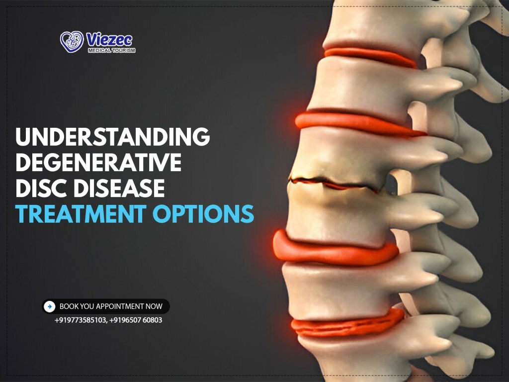Understanding-Degenerative-Disc-Disease-Treatment-Options