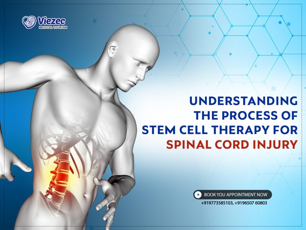 Stem Cell Therapy for Spinal Cord Injury