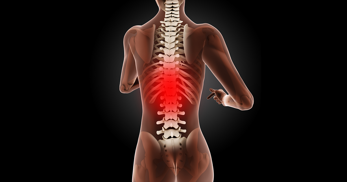 degenerative disc image