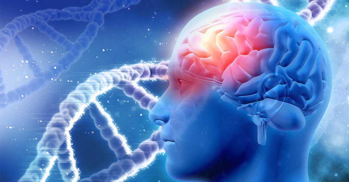 an illustration image of septo optic dysplasia