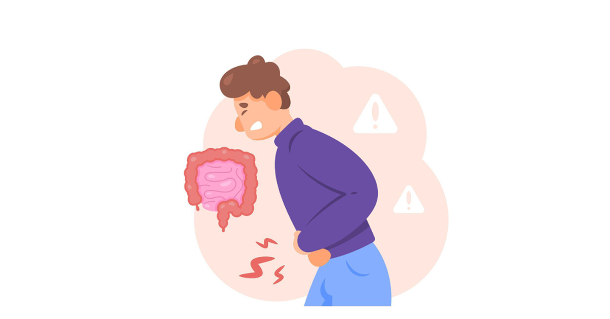 An illustrative image of inflammatory bowel disease