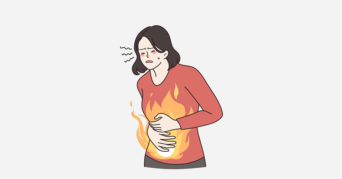 illustrative image of ulcerative colitis