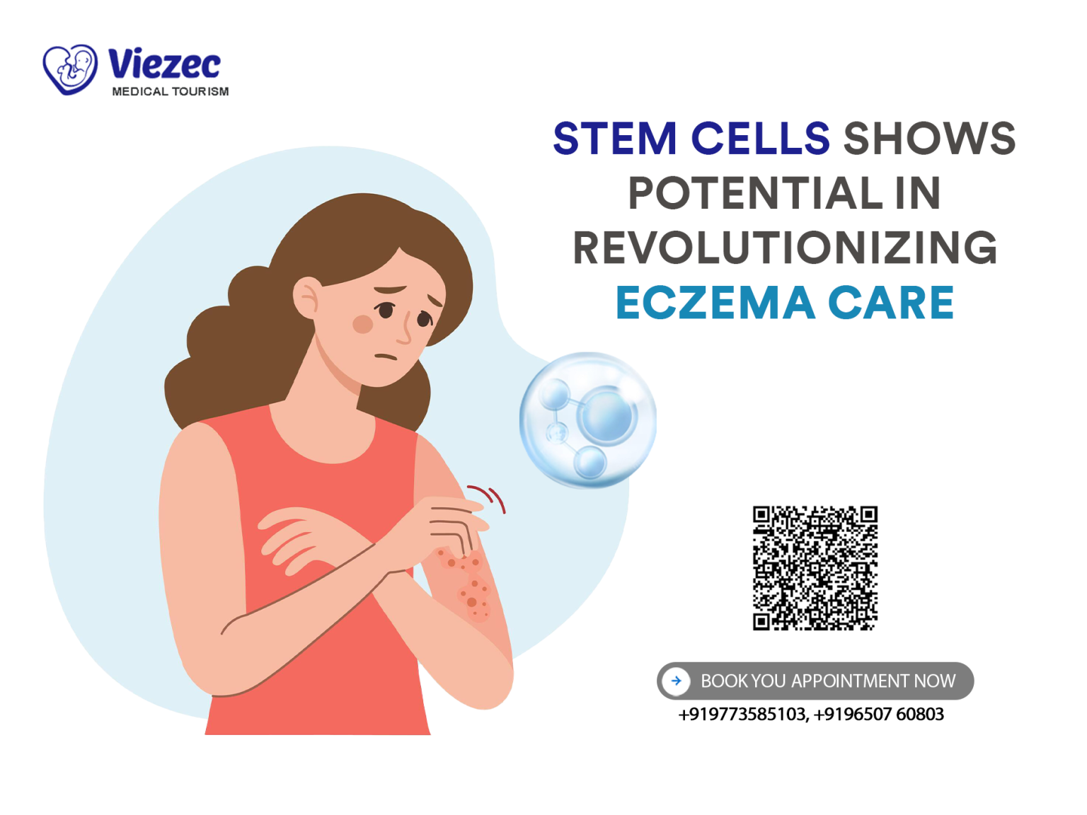 Eczema Care: How Stem Cells Are Changing The Game