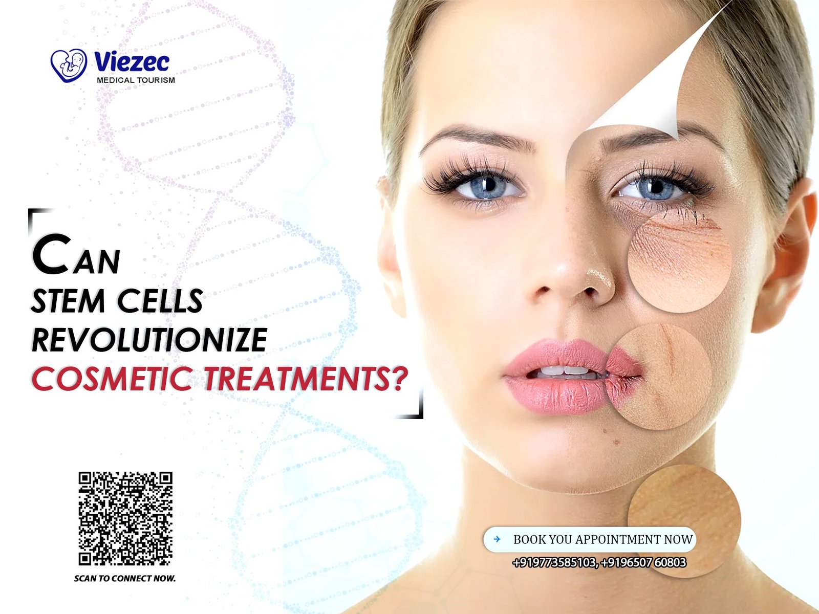 Advanced cosmetic procedures using mesenchymal stem cells