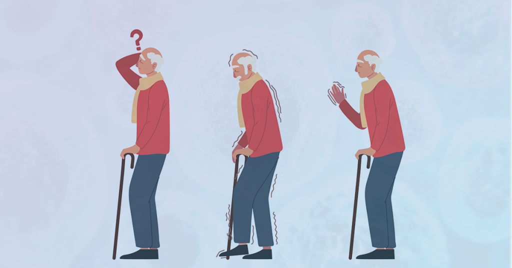 Stem cell therapy as an emerging treatment for Parkinson’s disease