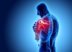 can rotator cuff injuries heal without surgery