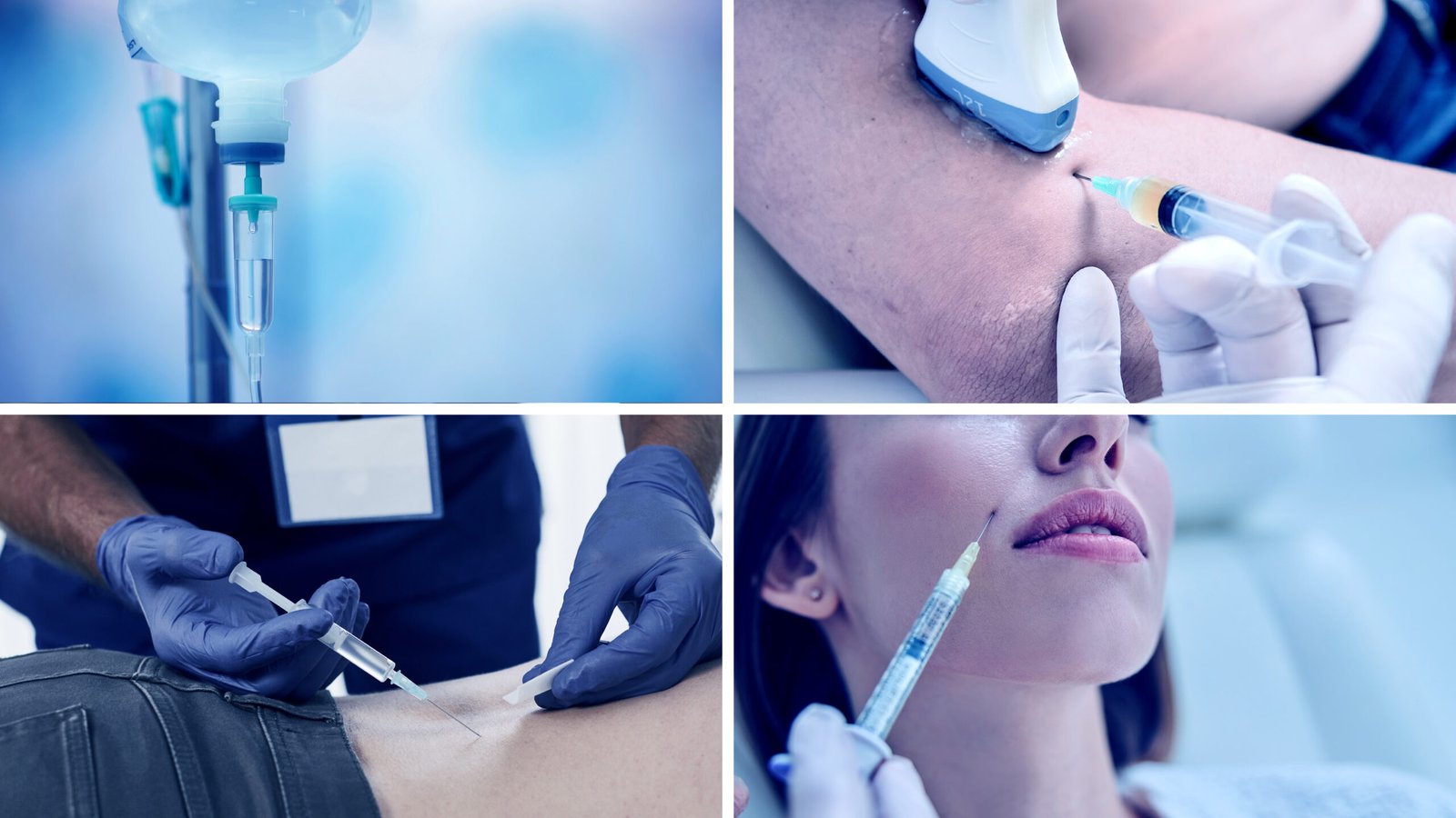 Stem cell delivery method