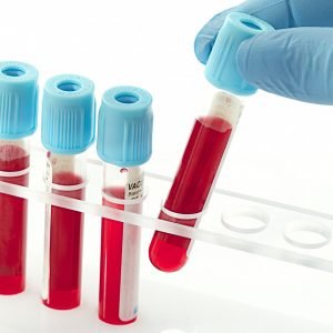 Stem Cell Collection