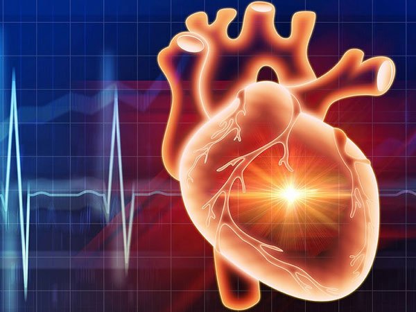 MSC therapy for cardiac and vascular disorders