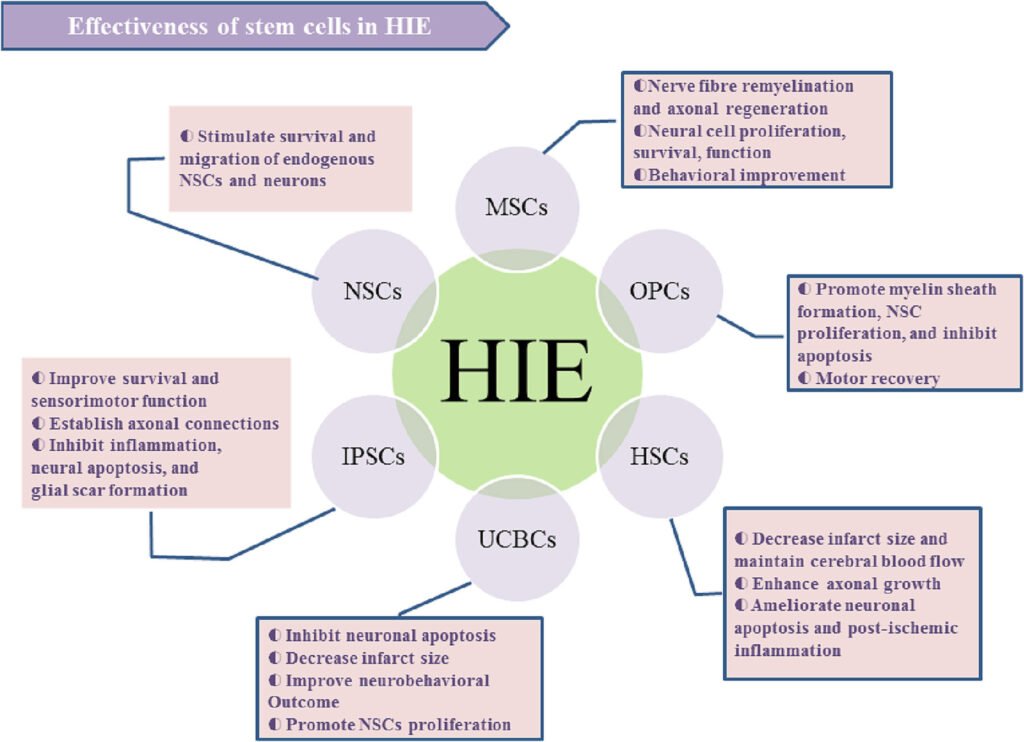 Infographic showing the process of stem cell therapy for Hypoxic Ischemic Encephalopathy from collection to treatment.