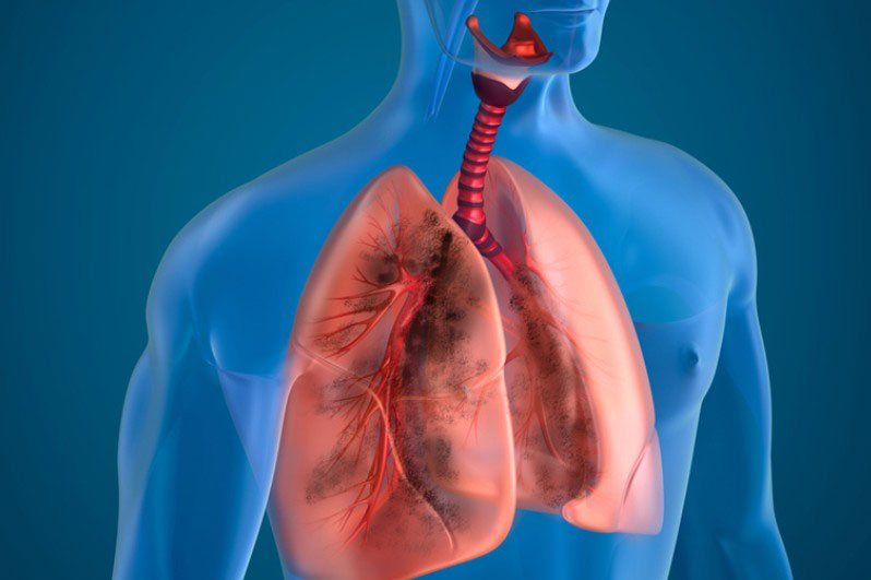 MSC therapy for lung and systemic disorders