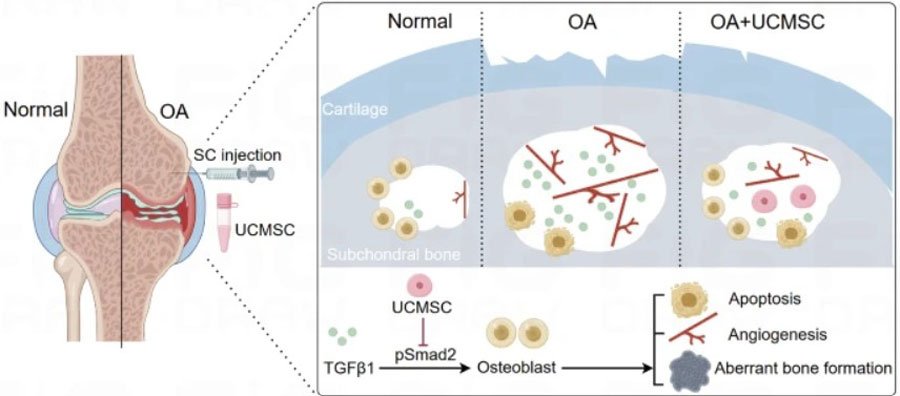Diagram showing stem cell injection into knee joint and cellular mechanisms