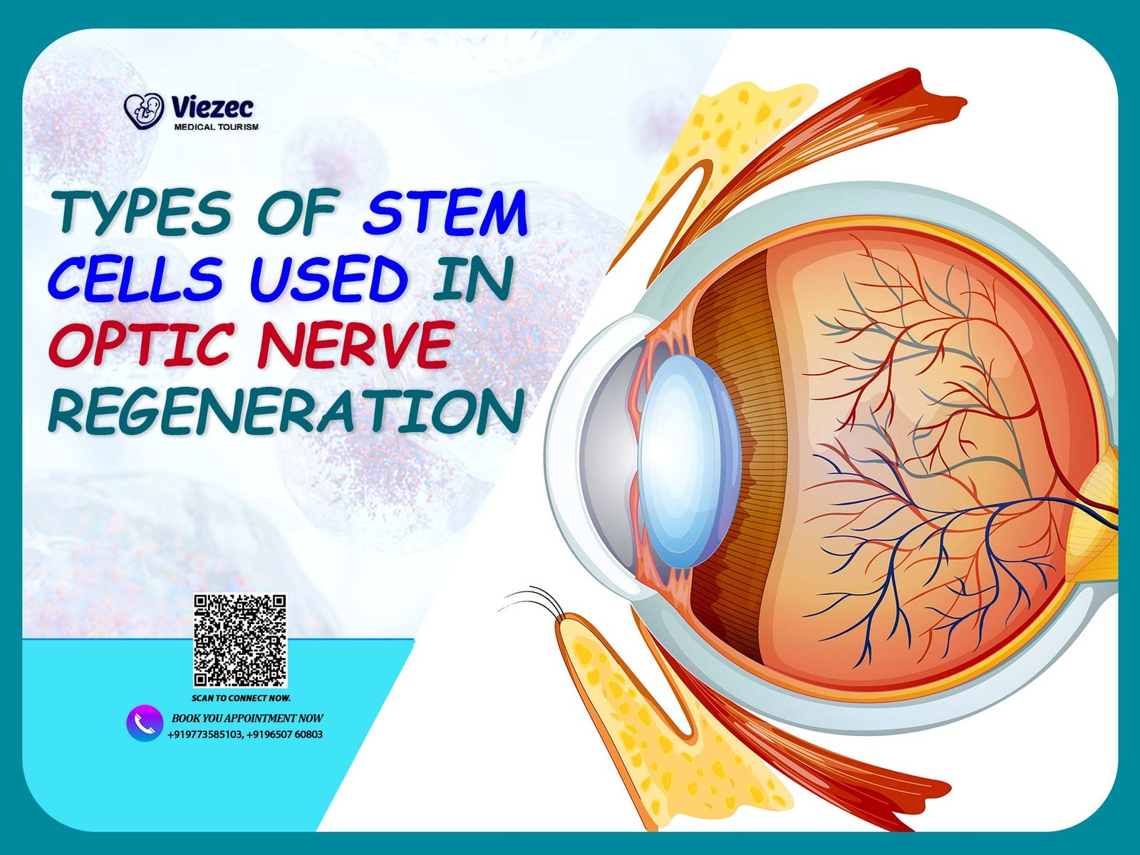 Types of stem cells used in optic nerve regeneration illustrated with eye anatomy diagram for stem cell therapy research.