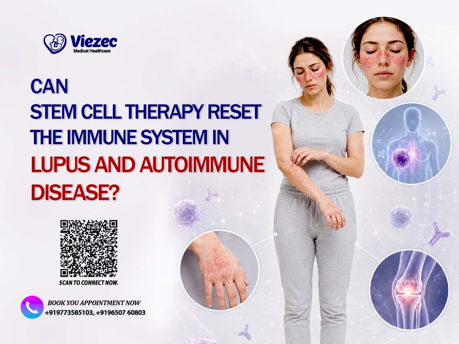 Can Stem Cell Therapy Reset the Immune System in Lupus and Autoimmune Disease?